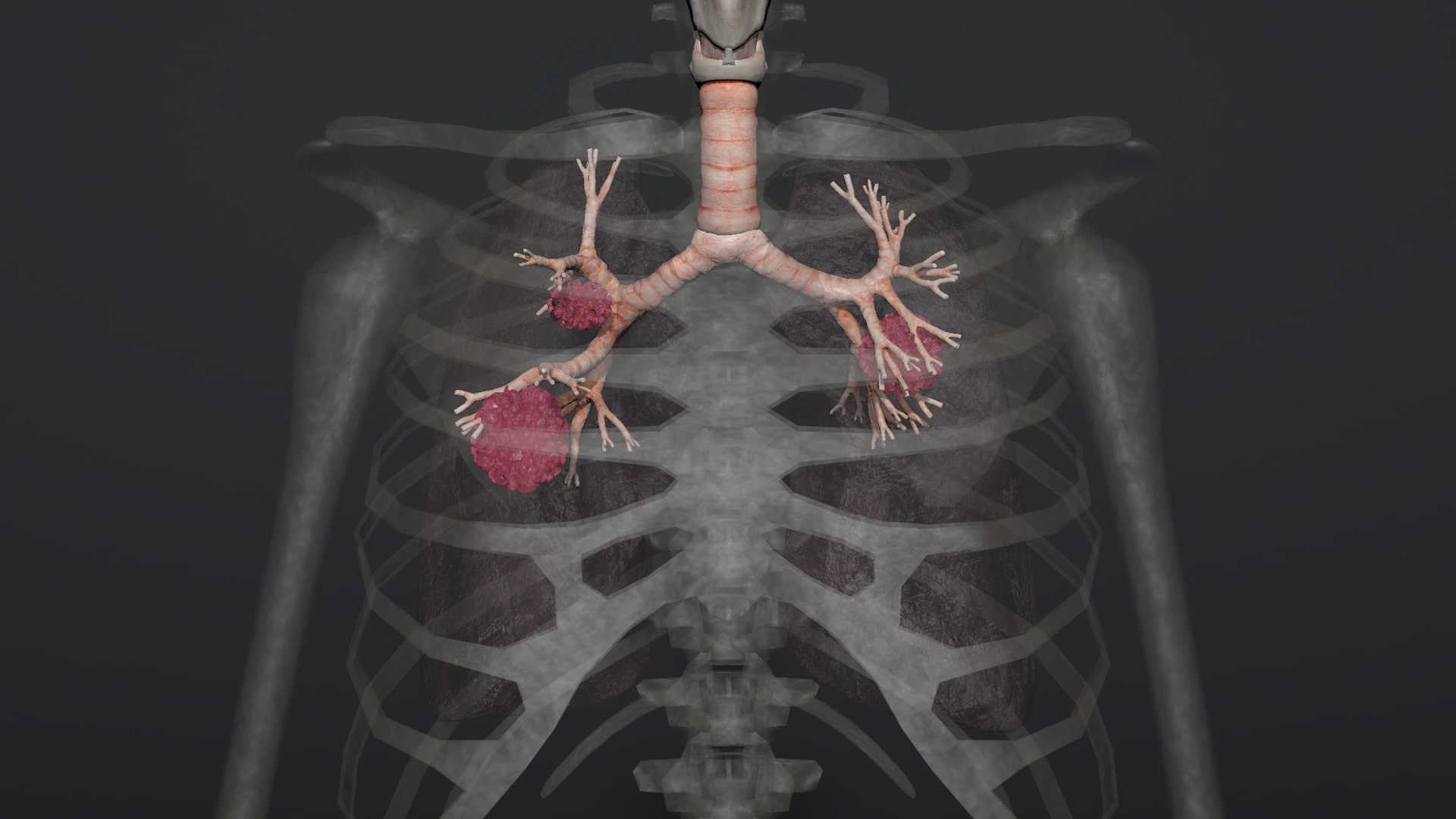 Asbestos Awareness
